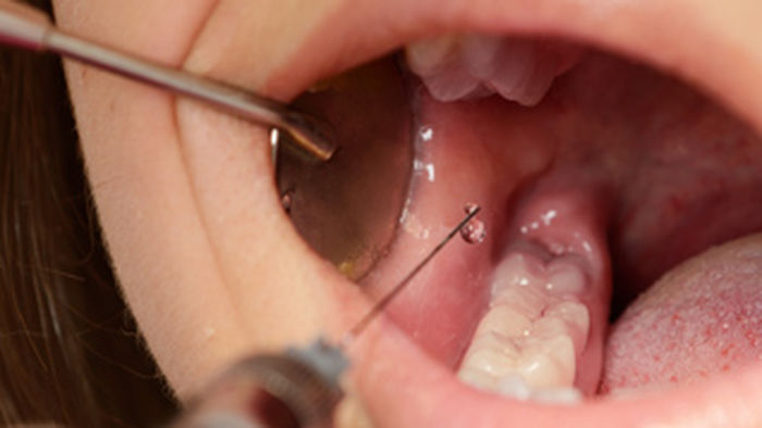 Katta kokraklar tomonidan vasvasaga solingan jinsiy aloqa