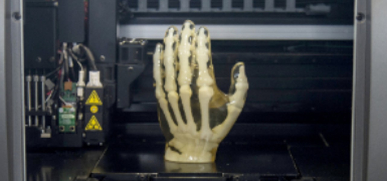 Gunstige Handprothesen Aus Dem 3d Drucker