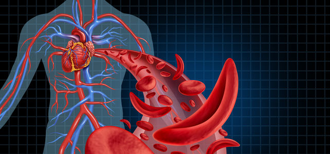 Spektrum Hämatologie: Patientenakte SCD: von A wie Akute Schmerzkrise